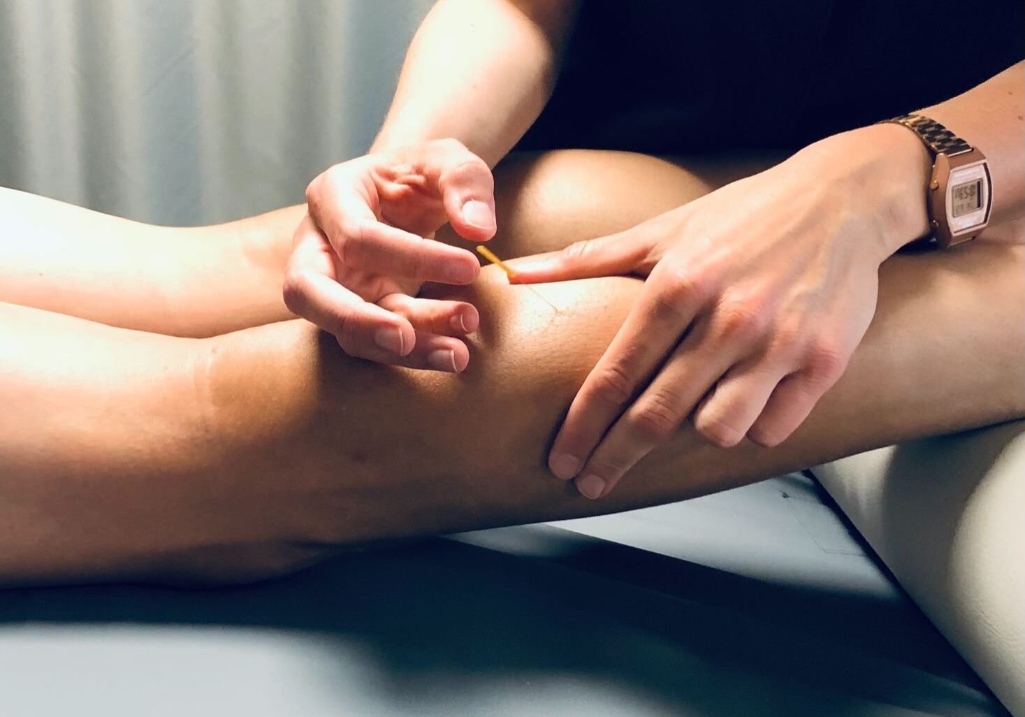 dry needling 2 dry needling 2