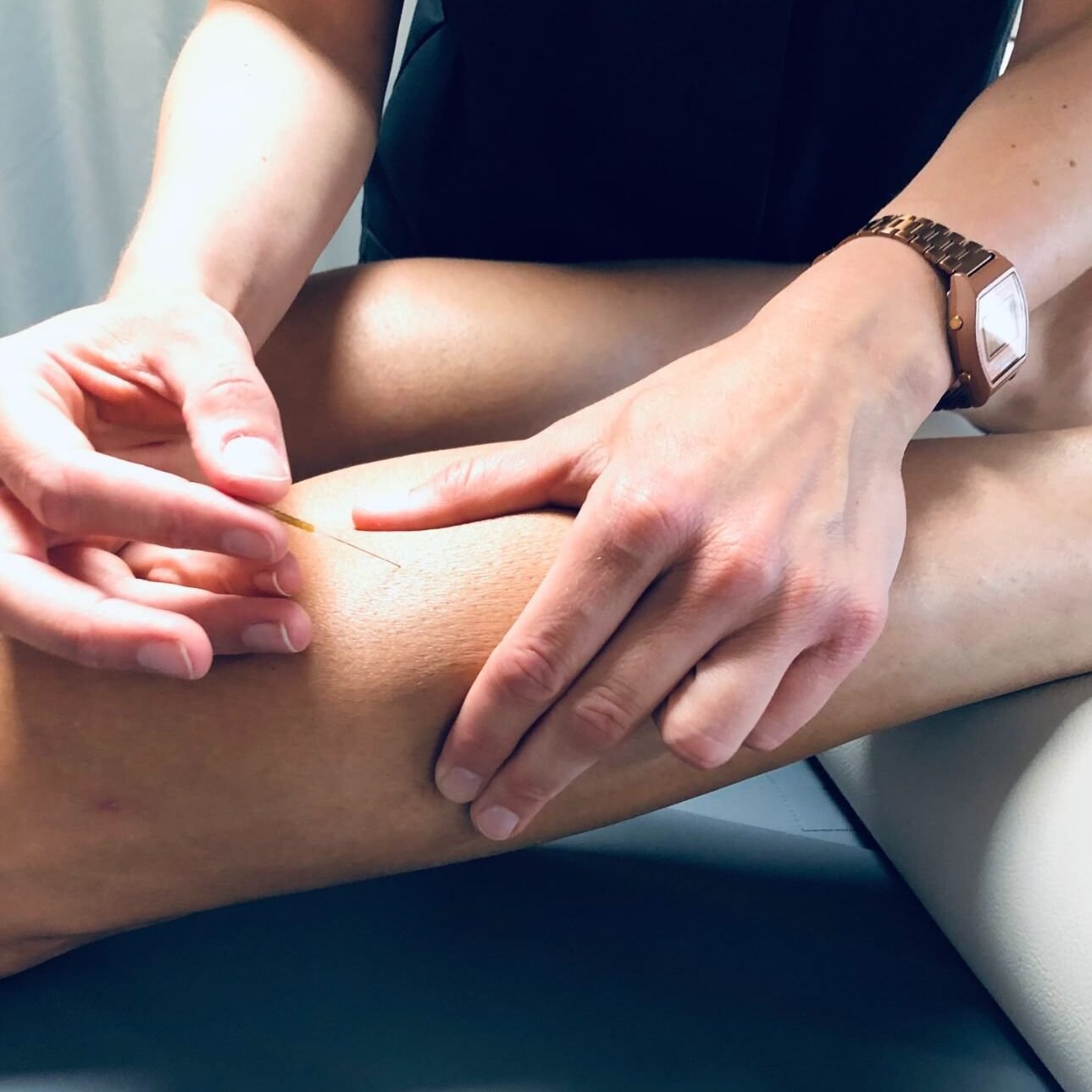 dry needling